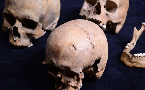 Tallinna võllamäelt leitud koljud. Esiplaanil on surmaaegse otsmikuluuvigastusega mehe kolju.