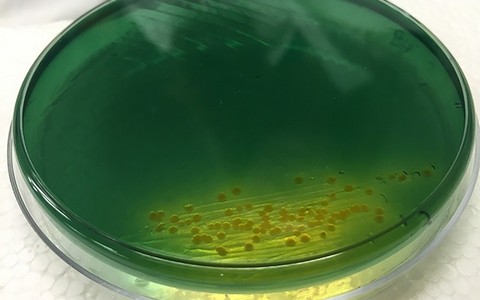 Kooleratekitaja Vibrio cholerae